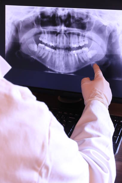 Best Emergency Root Canal Treatment in Tyrone, PA