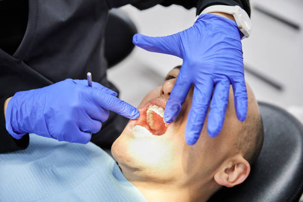 Best Emergency Dental Care for Broken or Chipped Teeth in Tyrone, PA