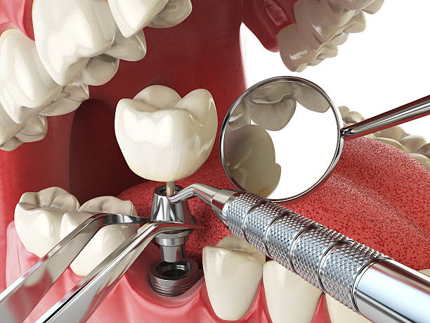 Best Emergency Treatment for Dental Infections or Abscesses in Tyrone, PA